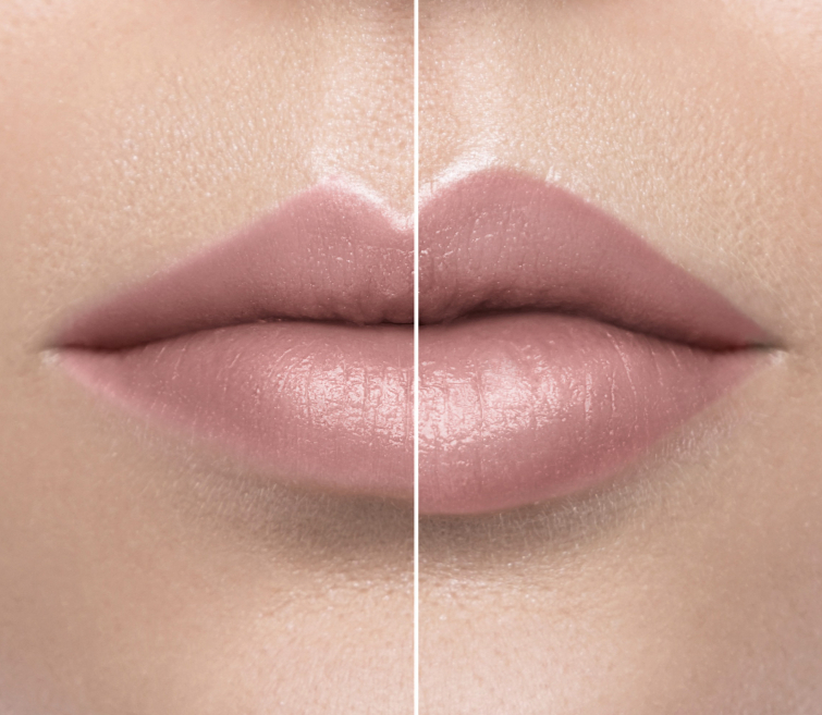 Aesthetics 4 Closeup of beautiful lips, before and after aesthtic dermal filler procedure